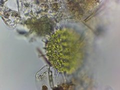 Pseudopediastrum boryanum longicorne