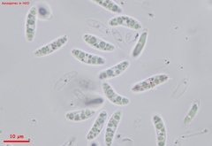 Chlorencoelia versiformis