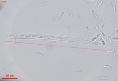 Chlorencoelia versiformis