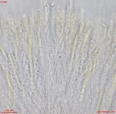 Chlorencoelia versiformis