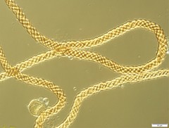 Trichia botrytis