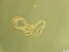 Trichia botrytis