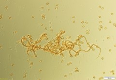 Trichia botrytis