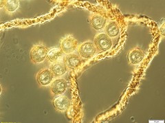 Trichia botrytis