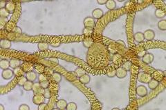 Arcyria stipata
