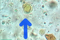 Blastocystis hominis