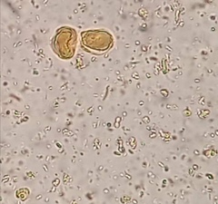 Blastocystis hominis