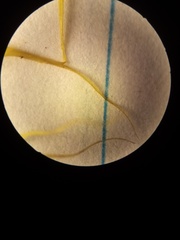 Dicranoloma robustum