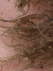 Endocladia
