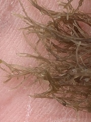 Endocladia
