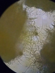Ditiola peziziformis image