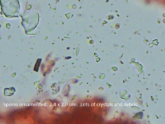 Trechispora farinacea