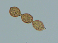 Botryobasidium simile