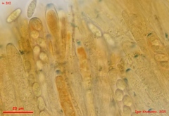 Pyrenopeziza personata