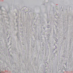 Pyrenopeziza personata