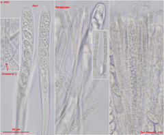 Pyrenopeziza personata