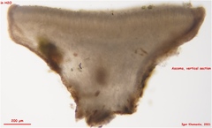 Pyrenopeziza personata