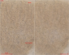 Pyrenopeziza personata