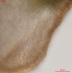 Pyrenopeziza personata