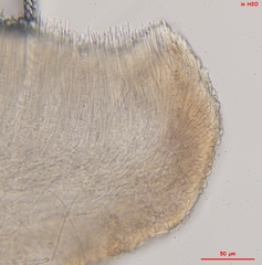 Pyrenopeziza personata