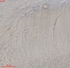 Hymenoscyphus imberbis