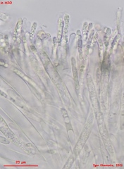 Hymenoscyphus imberbis