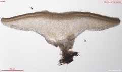 Hymenoscyphus imberbis