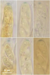 Hymenoscyphus imberbis