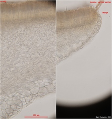 Hymenoscyphus imberbis