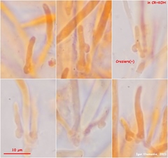 Hymenoscyphus imberbis