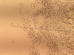 Dictyocatenulata alba