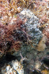Vulsella