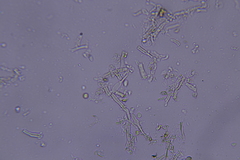 Hyphodontia arguta