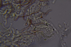 Scytinostroma protrusum