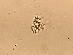 Dictyocatenulata alba