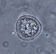 Cochliopodium