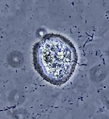 Cochliopodium