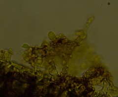 Botryobasidium capitatum