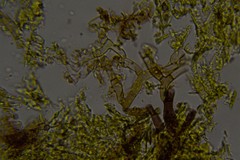 Botryobasidium capitatum