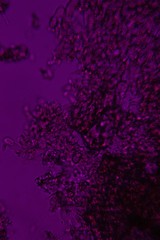 Botryobasidium capitatum