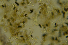 Scotomyces subviolaceus