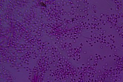 Leucogloea compressa image