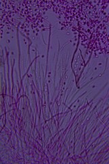 Leucogloea compressa image