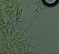 Radulomyces confluens