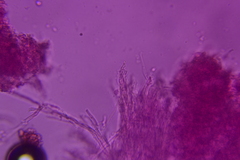 Hyphodontia arguta