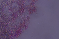 Hyphodontia arguta