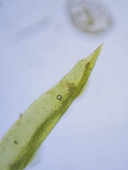 Trichostomum brachydontium