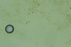 Lyomyces erastii