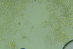 Lyomyces erastii