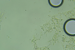Lyomyces erastii
